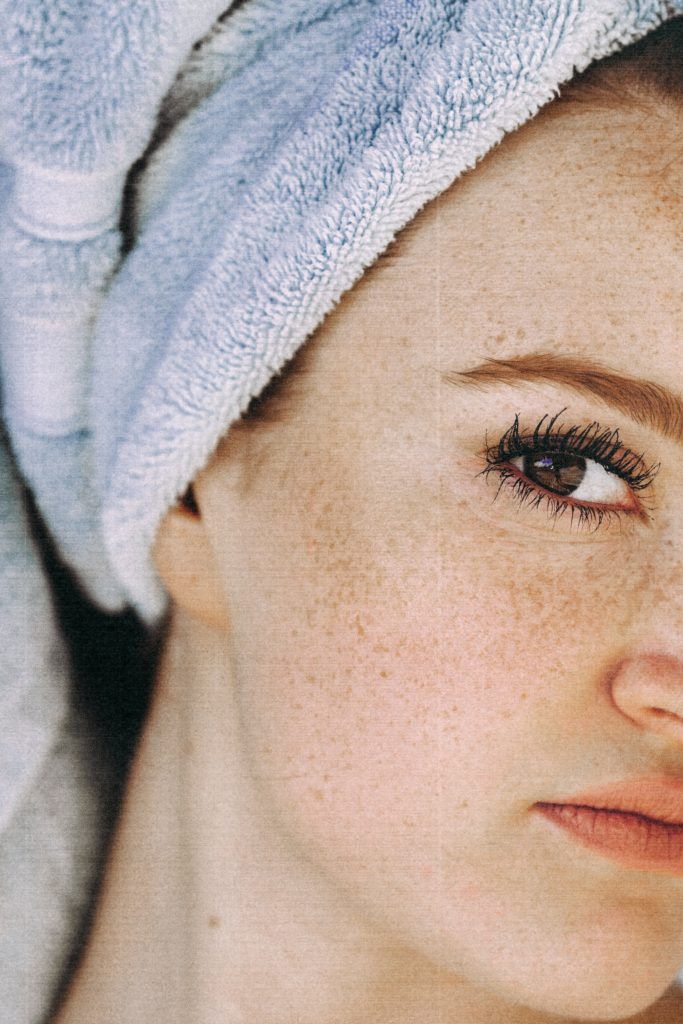 Nahaufnahme eines Gesichts mit Sommersprossen als Beispiel für dermatologische Untersuchungen und Hautkrebsvorsorge